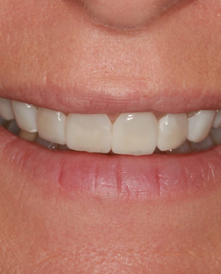 Treatment - Visage Dental