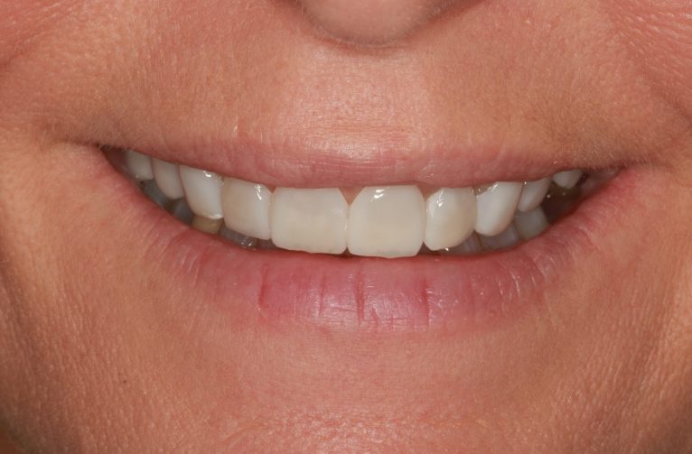 After -Visage Dental