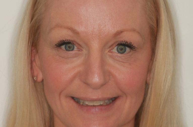 Before - Visage Dental