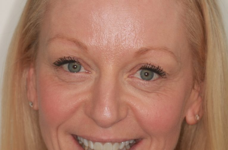 After -Visage Dental