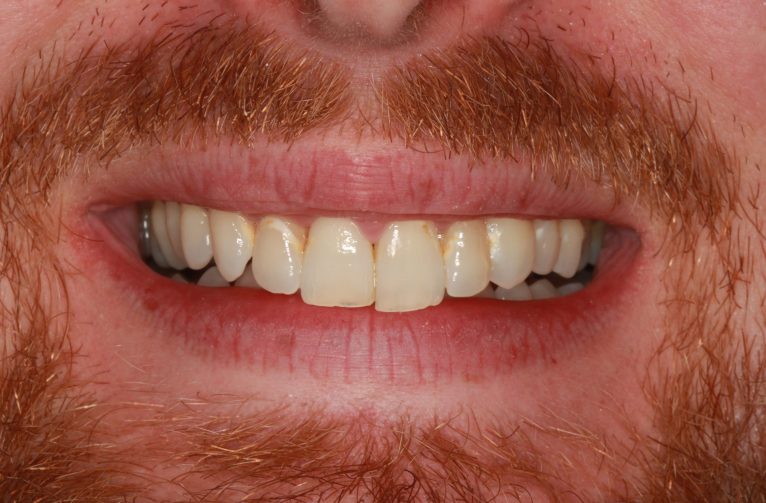 Before - Visage Solutions
