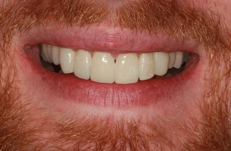 After - Visage Solutions