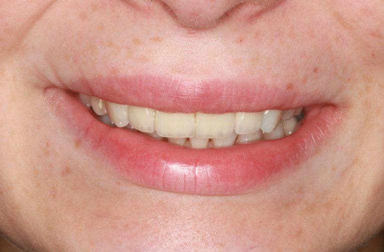After -Visage Dental
