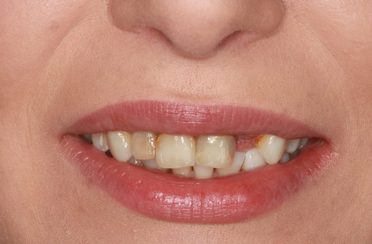 Before - Visage Dental